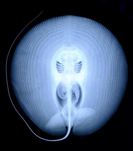 x-ray-of-a-stingray